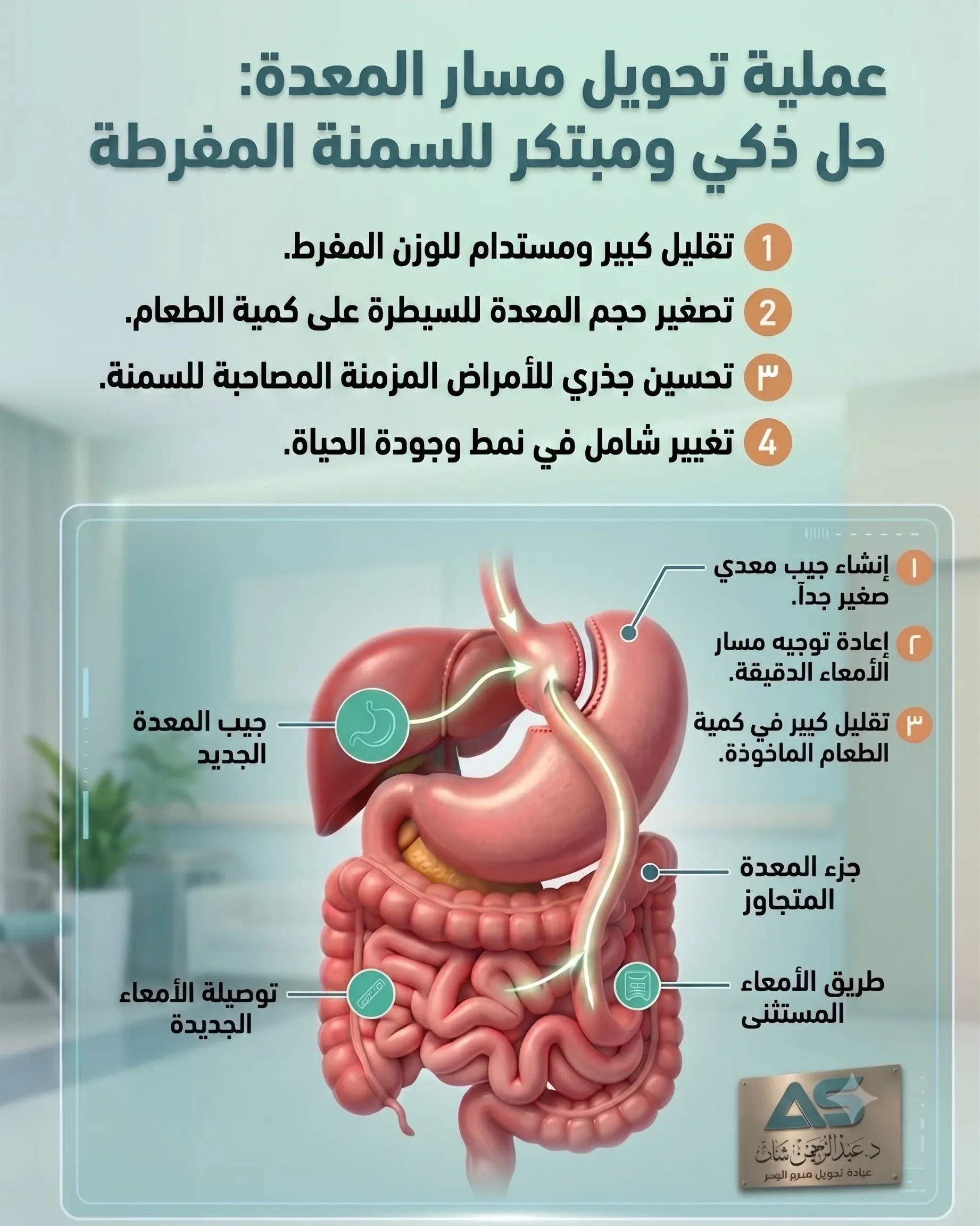 عملية تحويل مسار المعدة